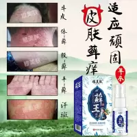 雅美肤癣王喷剂牛皮癣银屑病皮肤用手足癣头皮癣疥癣花斑癣脱皮真菌感染大腿内侧瘙痒股癣膏鹅掌风手癣藓 雅美肤癣王喷剂鹅掌