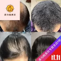 好货优选氧之源无硅油生姜洗发水发增发密发男女士老姜王控油去油