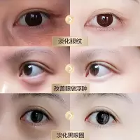 眼部紧致精华法国by碧欧biotic帝克眼霜蒂克去眼袋祛眼袋