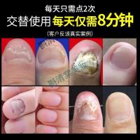专营店平液1瓶 灰甲赛康苹平专用液专用液认准