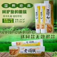 大腿两侧男女性下面体痒肛外大腿两侧根部瘙痒霉菌的中藥