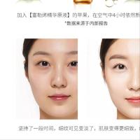 安平去斑玻尿酸原液院专用玻璃酸小安平去斑精华液补水玻料酸