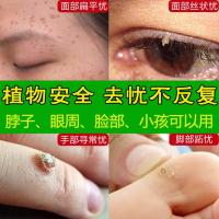 普朗克疣普朗克忧尖銳疣濕疣膏特傚私处男性 扁平疣去除膏面部日本去疣灵