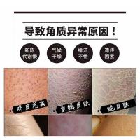 朵纪咖啡海盐朵纪咖啡按摩海盐去鸡皮去蛇皮祛鱼鳞皮腿部抖音磨砂膏男女