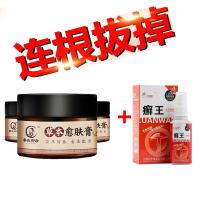 紫椒癣酊牛皮成人外用软膏止痒銀屑病鲜蘚老偏方銀屑膏股藓头癬健健华牛敏膏古股叶克灵软膏宛一堂湿毒康膏