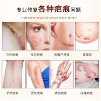 美丽疤痕灵定康美丽疤痕灵淡疤平疤修复疤痕淡痘印祛痘刀疤烟疤硅酮霜顺宁堂九凡膏巴卫宁 正品膏