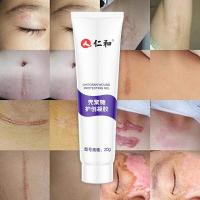 仁和膏 淡疤修复刨腹产手术刀疤凹凸疤儿童烧伤烫伤膏去除疤痕膏疙瘩增生淡老旧浅疤印贴产品凝胶 壳聚糖护创凝胶20
