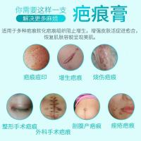 去疤痕膏硅酮痕凝胶修复女性剖腹产手术刀疤烫伤儿童产妇增生疤复平疤痕灵祛痘印克巴除疤凹凸贴 一盒