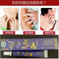 脚底骚痒治皮肤干燥瘙痒身上起疙瘩红点老年人手痒脚底痒脱皮止痒膏外用