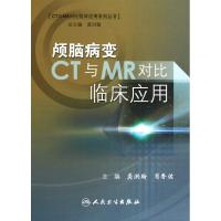 11颅脑病变CT与MR对比临床应用978711713361622