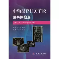 11中轴型脊柱关节炎磁共振检查978750918536022
