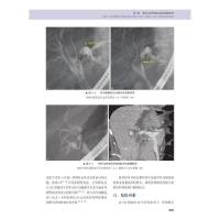 11复杂疑难胆胰疾病高级ERCP教程978750468646622