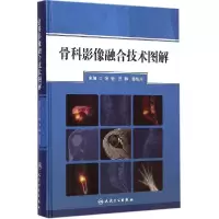 11骨科影像融合技术图解978711720068422