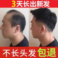 [优先发货][3天快速生发]防脱发洗发水生姜洗发水防脱发增发密发去屑生发