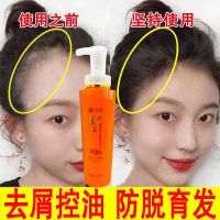 [优先发货]正品九叶老姜王生姜洗发水防脱发生发增发密发去屑控油洗发水