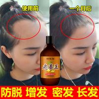 [优先发货]防脱发生姜洗发水防脱育发增发密发快速变长控油去屑洗发露500ml