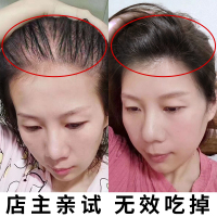 [优先发货][小红书达人推荐]生姜洗发水 头发自然生长速度 变密变多变长 重度脱发,秃斑专用(家庭套餐) 400mL