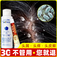 [优先发货]去头皮屑神器克星止痒煤焦油洗发水露正品头屑癬除头螨虫头皮清洁 100mL