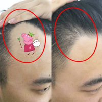 [优先发货][拯救发际线]生姜洗发水 头发自然生长速度 变密变多变长 200mL