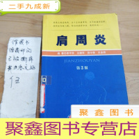 正 九成新肩周炎