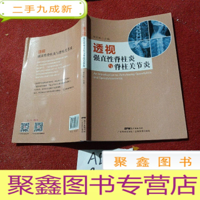 正 九成新透视强直性脊柱炎与脊柱关节炎