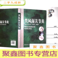 正 九成新类风湿关节炎
