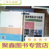 正 九成新脑肿瘤临床与病理