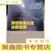 正 九成新肺结核病X线诊断图解