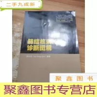 正 九成新肺结核病X线诊断图解