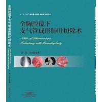 全胸腔镜下支气管成形肺叶切除术9787534976162河南科学技术出版社李简