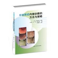 早期胃癌内镜诊断的方法与策略