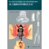 痔上黏膜环形切除钉合术y90