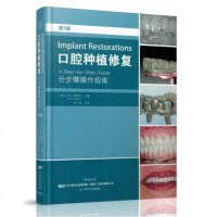 正版 口腔种植修复分步骤操作指南第3版 口腔种植临床牙体牙髓病学口腔修复正畸牙齿疾病口腔种植学