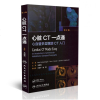 蹇冭剰CT涓鐐归蹇冭绠″灞傝灪鏃婥T鍏ラ棬 蹇冭剰瓒呭0 蹇冭剰鐥呭 瓒呭0鍖诲 鍖诲褰卞儚 椹檽娴蜂富