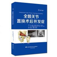 全髋关节置换术后并发症(精)髋关节相关解剖骨科医学书籍骨科手术入实用骨科学