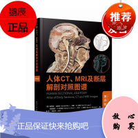 正版书籍 人体CT、MRI及断层解剖对照图谱(第四版)第4版放射科医生放射技师外科医生培训临床实践