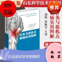 针灸与扳机点镇痛实用图解 针灸推拿按摩解剖物理治疗参考书籍9787572302190山东科学技术