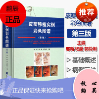 皮瓣移植实例彩色图谱第3版 辽宁科学技术出版社