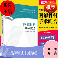 图解骨科手术配合 适合于初入手术室工作 手术室医护人员 手术步骤配以解剖 器械及具体操作的