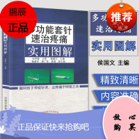 正版彩图 多功能套针速治疼痛实用图解 石学敏主审 侯国文主编 中国中医药出版新型浮针 皮下套管针灸临