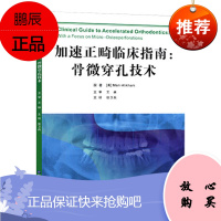 加速正畸临床指南 骨微穿孔技术 张卫兵主译 2018年10月出版 版次1 ping装 世