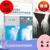 正版 闭合复位技术在四肢骨折治疗中的应用 医学 骨科 骨伤科 人民卫生出版社