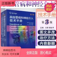 [正版新书]正版 脑血管病和神经介入技术手册第3版 马克·哈利根 心脑血管疾病临床案例诊治教程参考工具书 中国科学技术