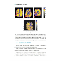 全新脑定量磁共振成像:物理测量原理