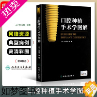 [正版]正版 口腔种植手术学图解 主编王少海 马威 口腔医学图谱 牙科诊所临床教程 牙体种植参考工具书籍 人民卫生出版社