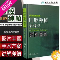 [正版]正版 口腔种植影像学 主编王虎 欧国敏 牙体种植临床案例诊治教程 口腔医学参考工具书籍 人民卫生出版社97871