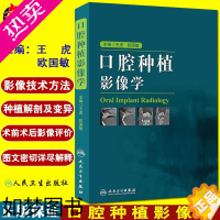 [正版]正版 口腔种植影像学 王虎 欧国敏主编 人民卫生出版社 口腔医学 医学影像诊断学书籍 口腔种植医学 供口腔临