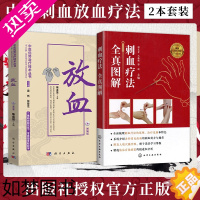 [正版]正版2册 刺血疗法全真图解+放血 放血疗法教程刺络法中医养生保健 中医 拔罐放血治百病针炙学王秀珍民间刺血术书籍