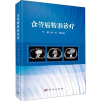诺森食管癌精准诊疗李涛,韩泳涛9787030728647科学出版社