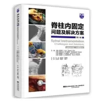 诺森脊柱内固定:问题及解决方案:challenges and solutions